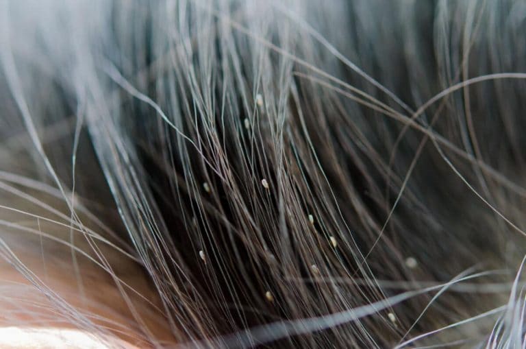 Death By Dying What Brand Of Hair Dye Kills Lice 