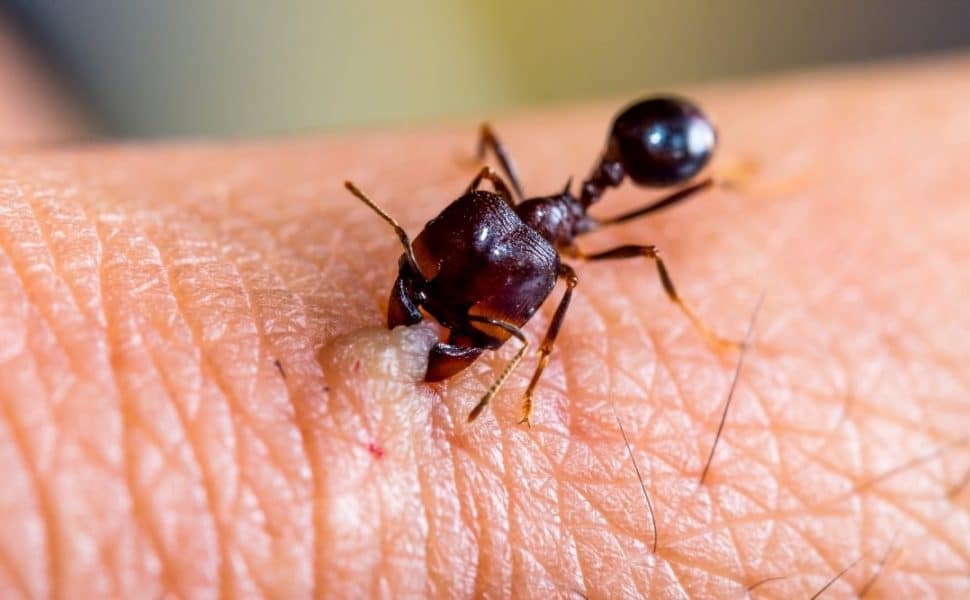 Ant Biting Human Hand